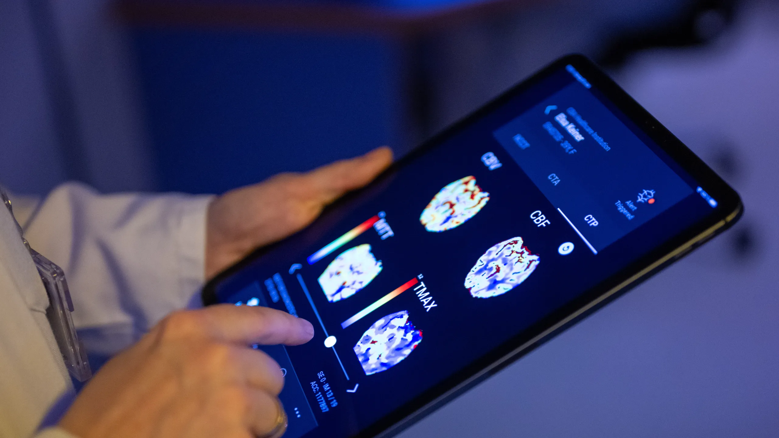 WideLabs: Innovazione per i Pazienti Affetti da Alzheimer