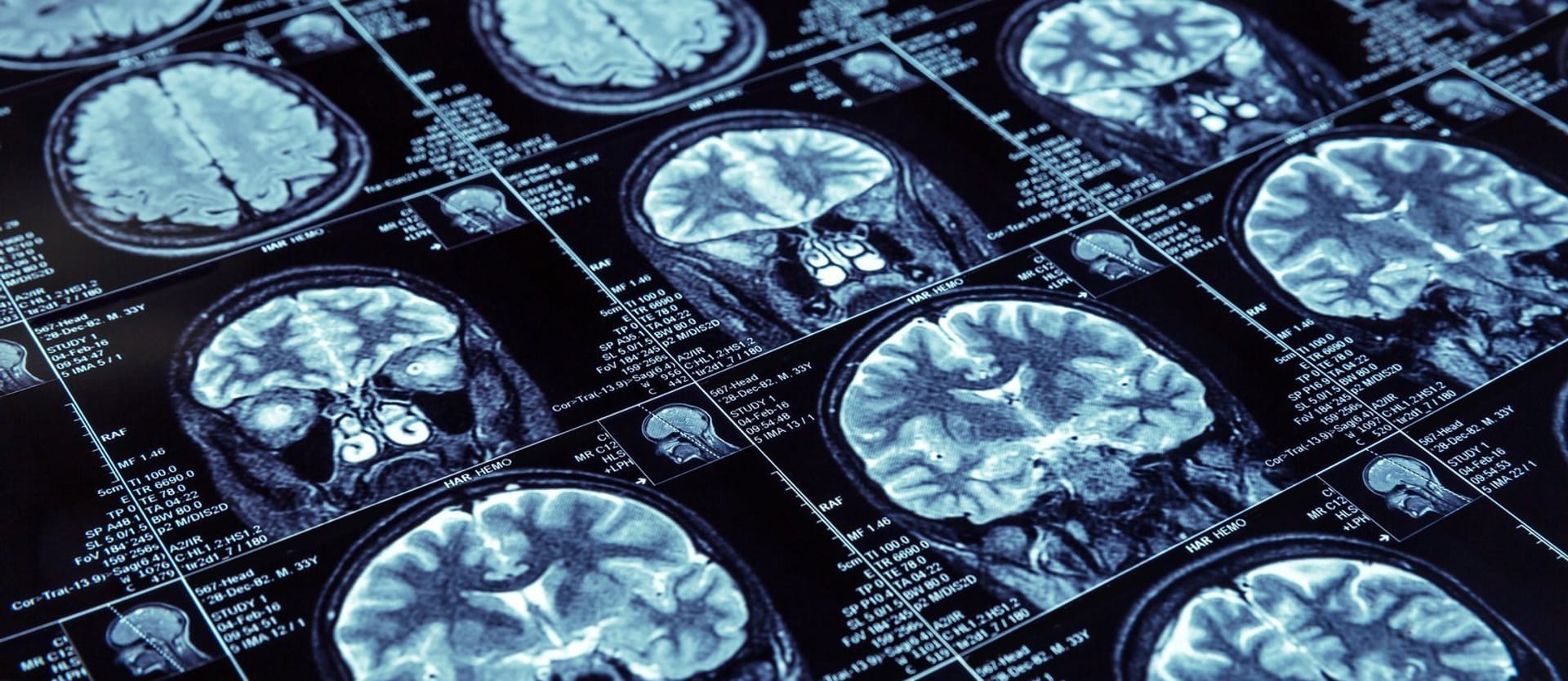 DEEP LEARNING prevede il rischio di malattia dalle immagini mediche 3D