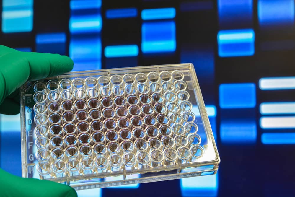 Nuovo test genomico diagnostica ogni tipo di infezione in 24 ore