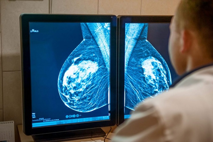 Premio a start up italiana: ha applicato l’IA alle mammografie